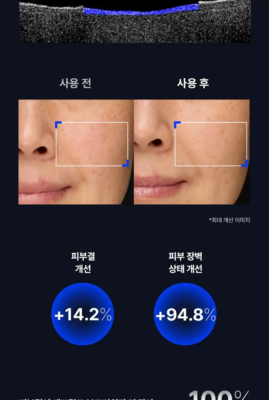 아이오페 레티놀 슈퍼 바운스 세럼 30ml 기획 (+15ml) 상세페이지 19