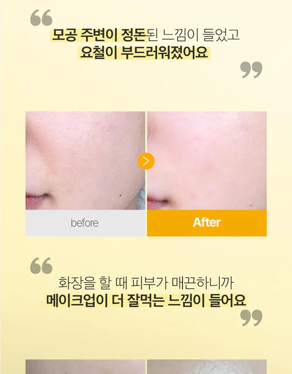에필로우 차가버섯 비피다 바이옴 매끈결 모공 앰플 50ml 상세페이지 14