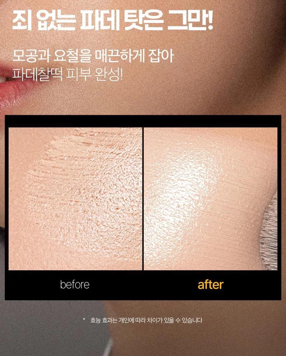 에필로우 차가버섯 비피다 바이옴 매끈결 모공 앰플 50ml 상세페이지 25
