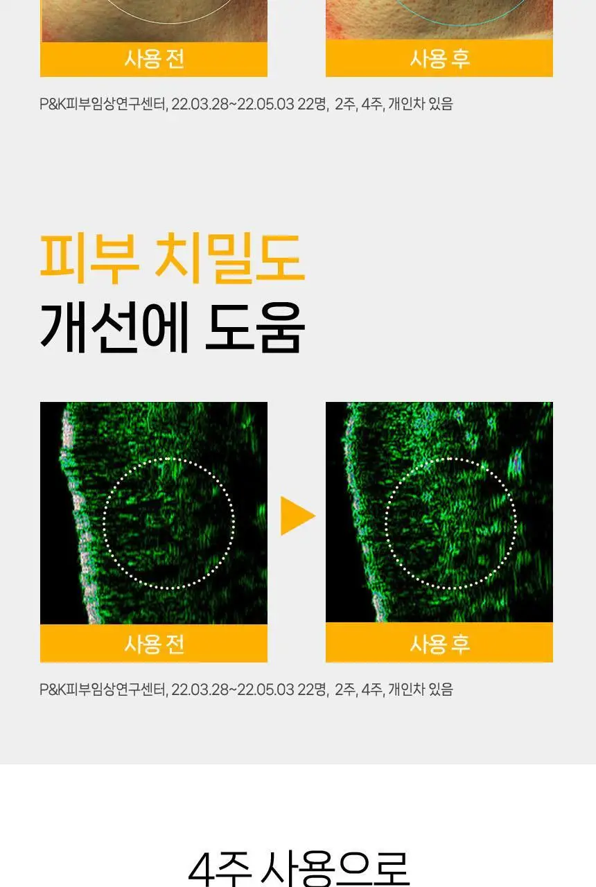 울트라브이 이데베논 프레스티지 앰플 10ml 상세페이지 18