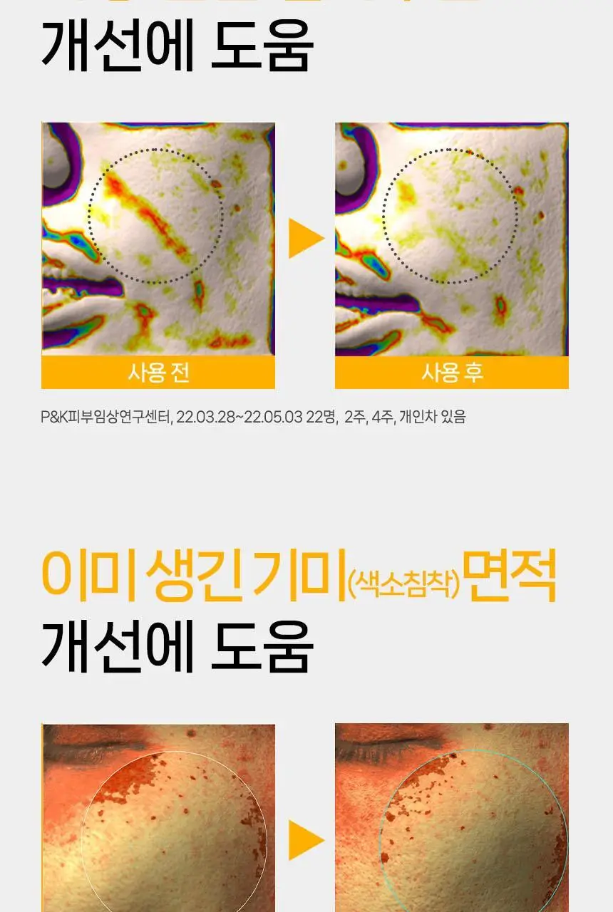 울트라브이 이데베논 프레스티지 앰플 3개입 상세페이지 17