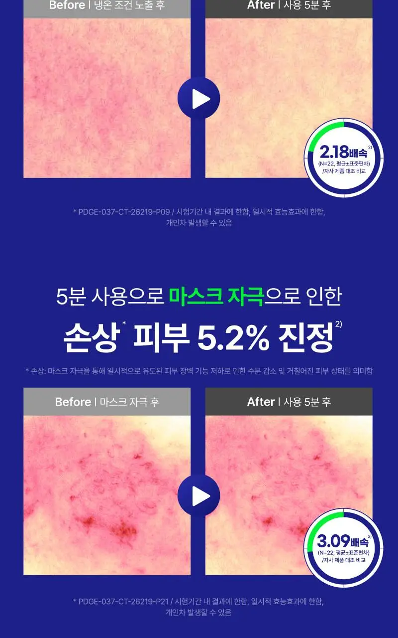 이지듀 EGFx 다운타임 세럼 40ml 기획(+오인트 겔 5ml) 상세페이지 18