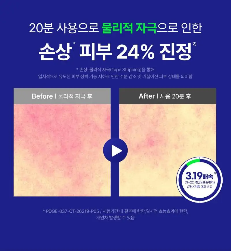 이지듀 EGFx 다운타임 세럼 40ml 기획(+오인트 겔 5ml) 상세페이지 19