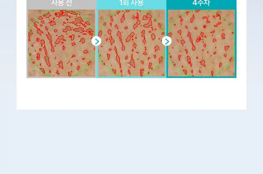 일소 펩타이드 3엑스 모공톡스 탄력 앰플 30ml 상세페이지 25