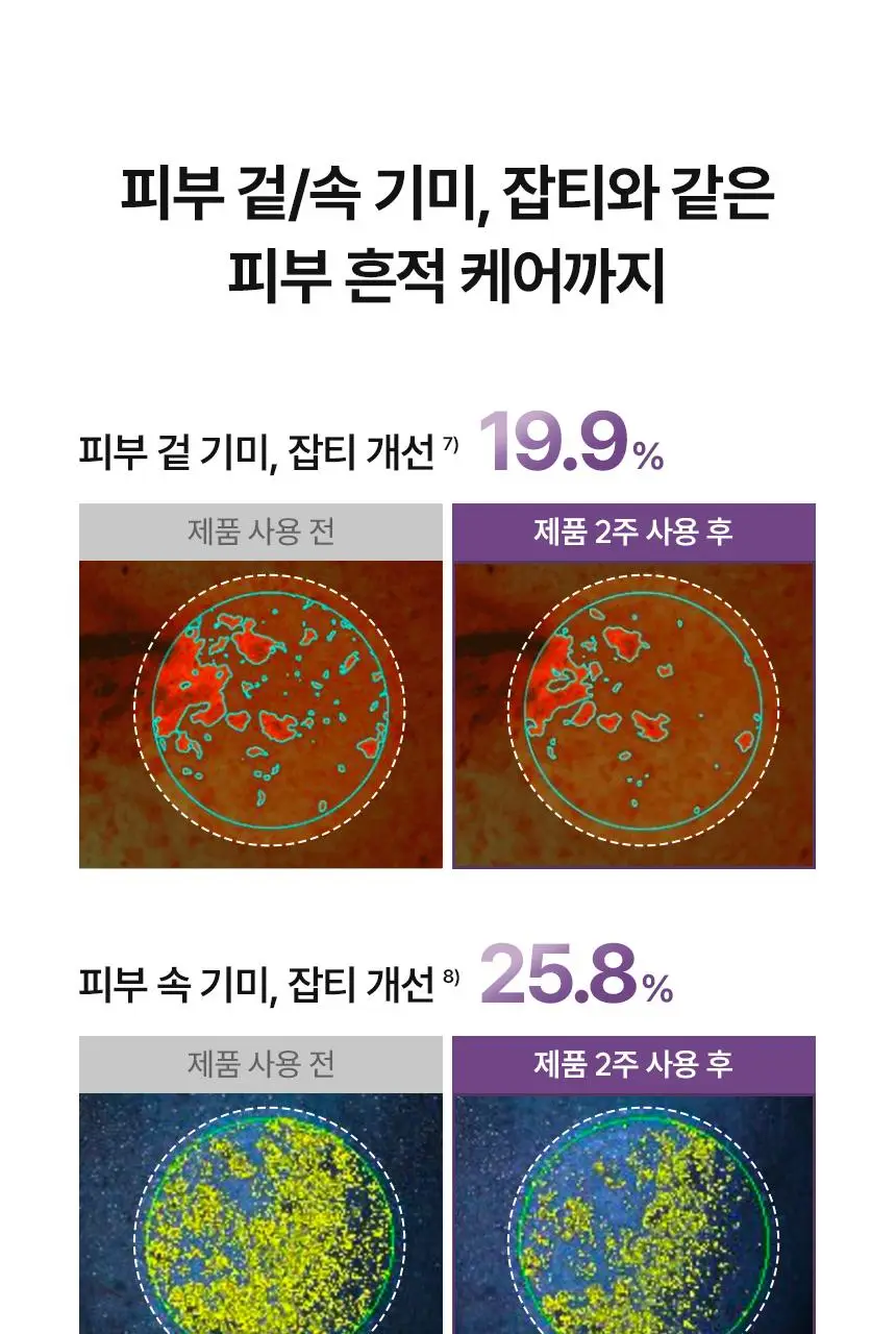 주미소 나이아신아마이드 10% 세럼 40ml 상세페이지 16