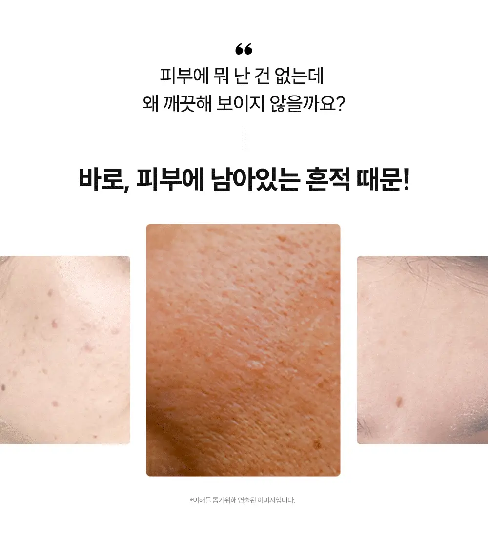 주미소 나이아신아마이드 20% 세럼 40ml 상세페이지 2