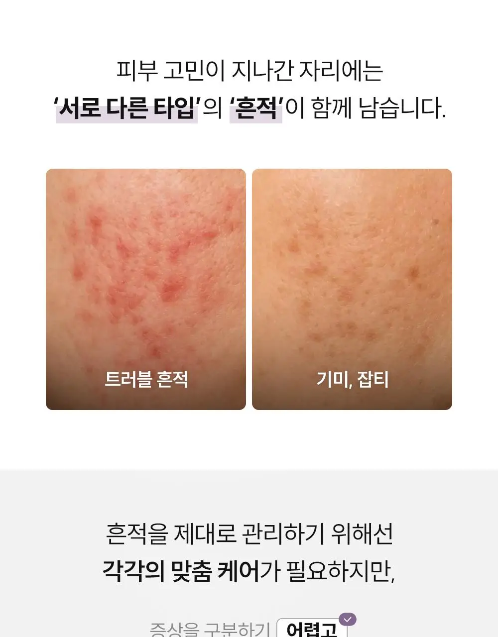 주미소 나이아신아마이드 20% 세럼 40ml 상세페이지 3