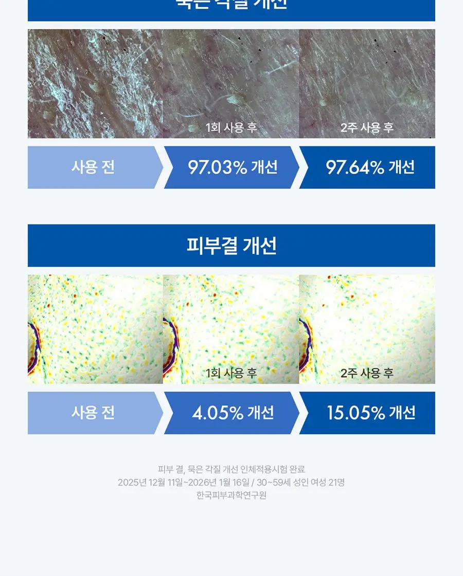 쥬베룩 PDLLA 리파이닝 퍼스트 에센스 150ml(단품/기획) 상세페이지 11