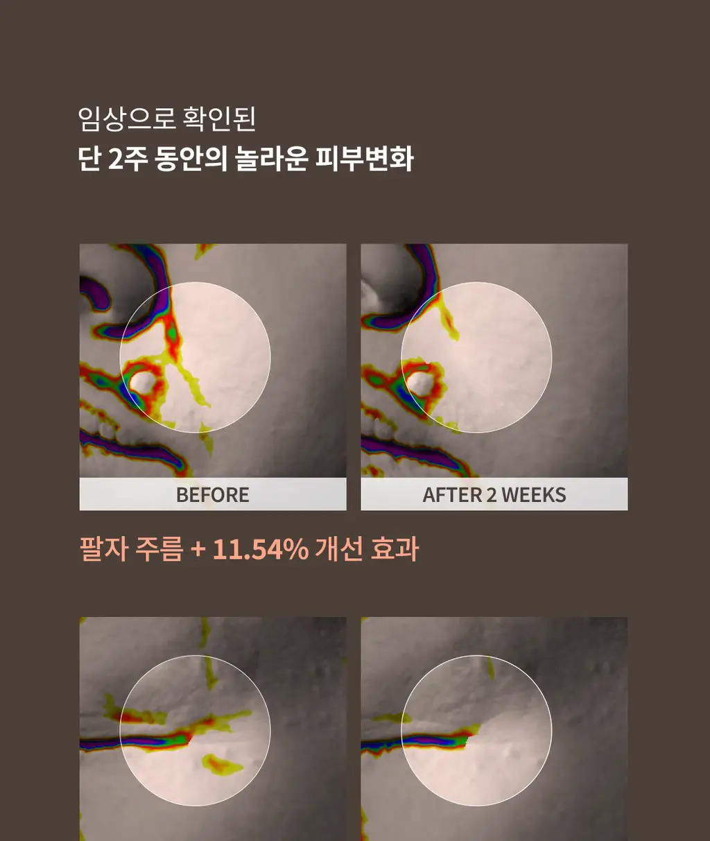 플로위 PDRN 트리플 코어 앰플 30ml 상세페이지 5