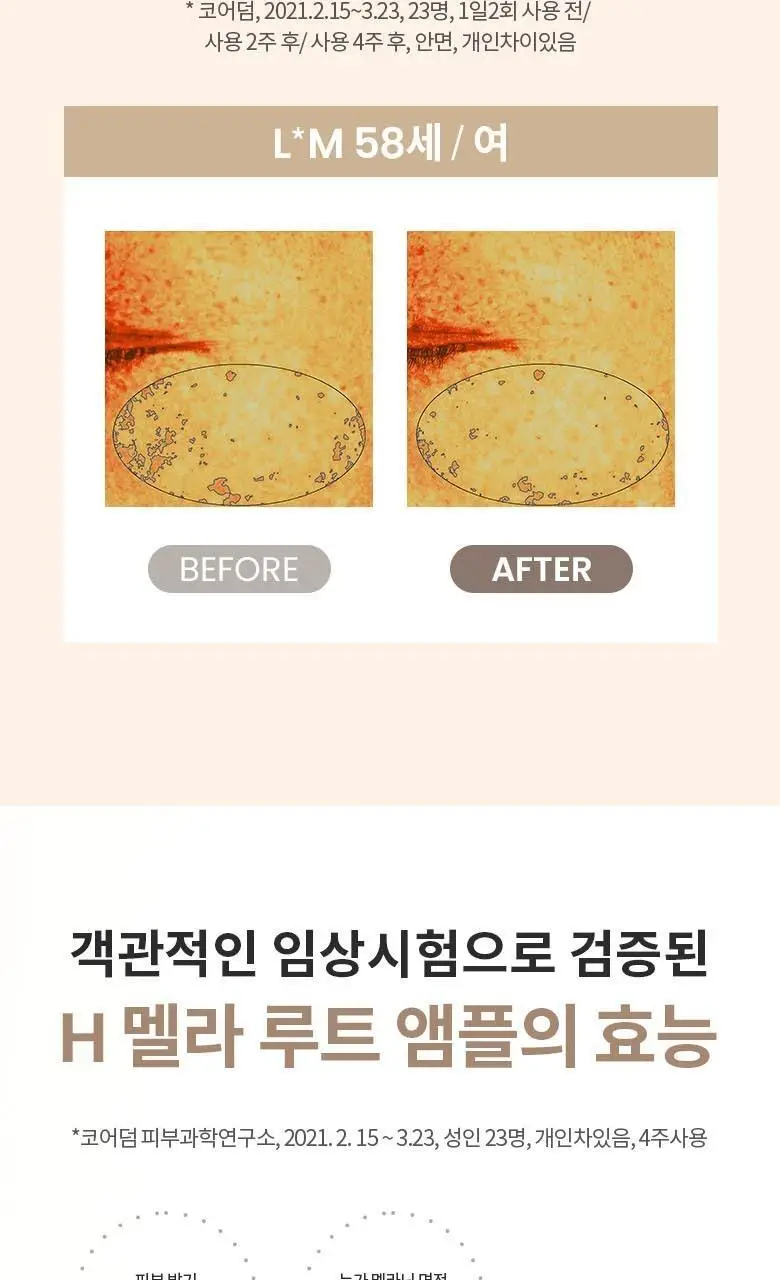 AHC 에이치 멜라루트 앰플 스페셜 기획 (앰플10ml*2+크림20ml+앰플4.5ml 증정) 상세페이지 10