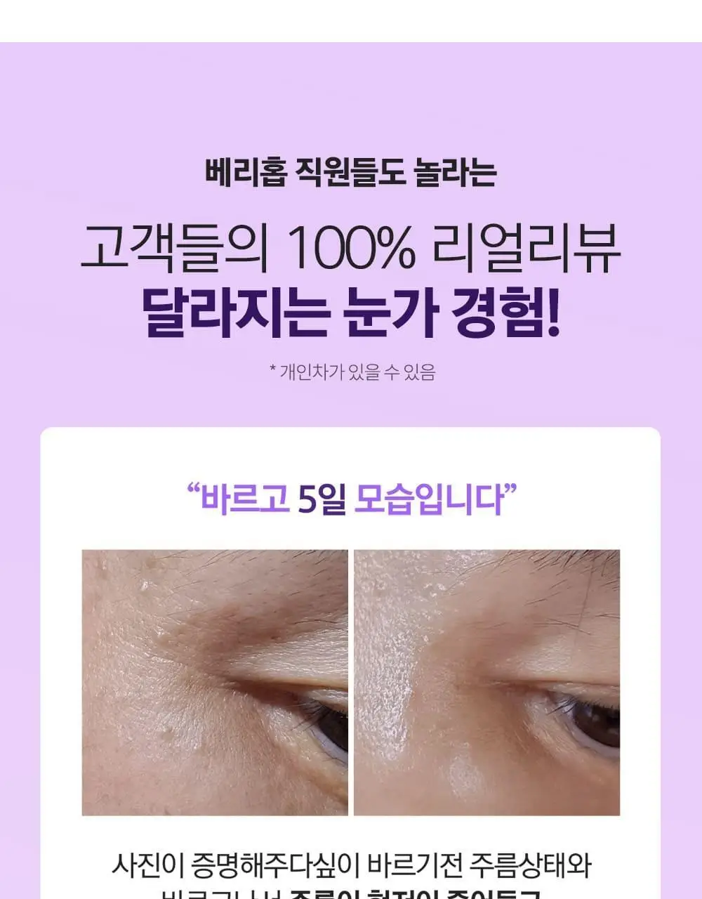베리홉 바이오틱스 바이탈 아이 크림 20ml 상세페이지 2