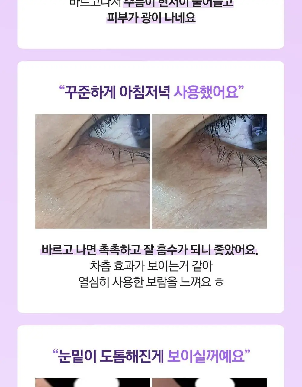 베리홉 바이오틱스 바이탈 아이 크림 20ml 상세페이지 3
