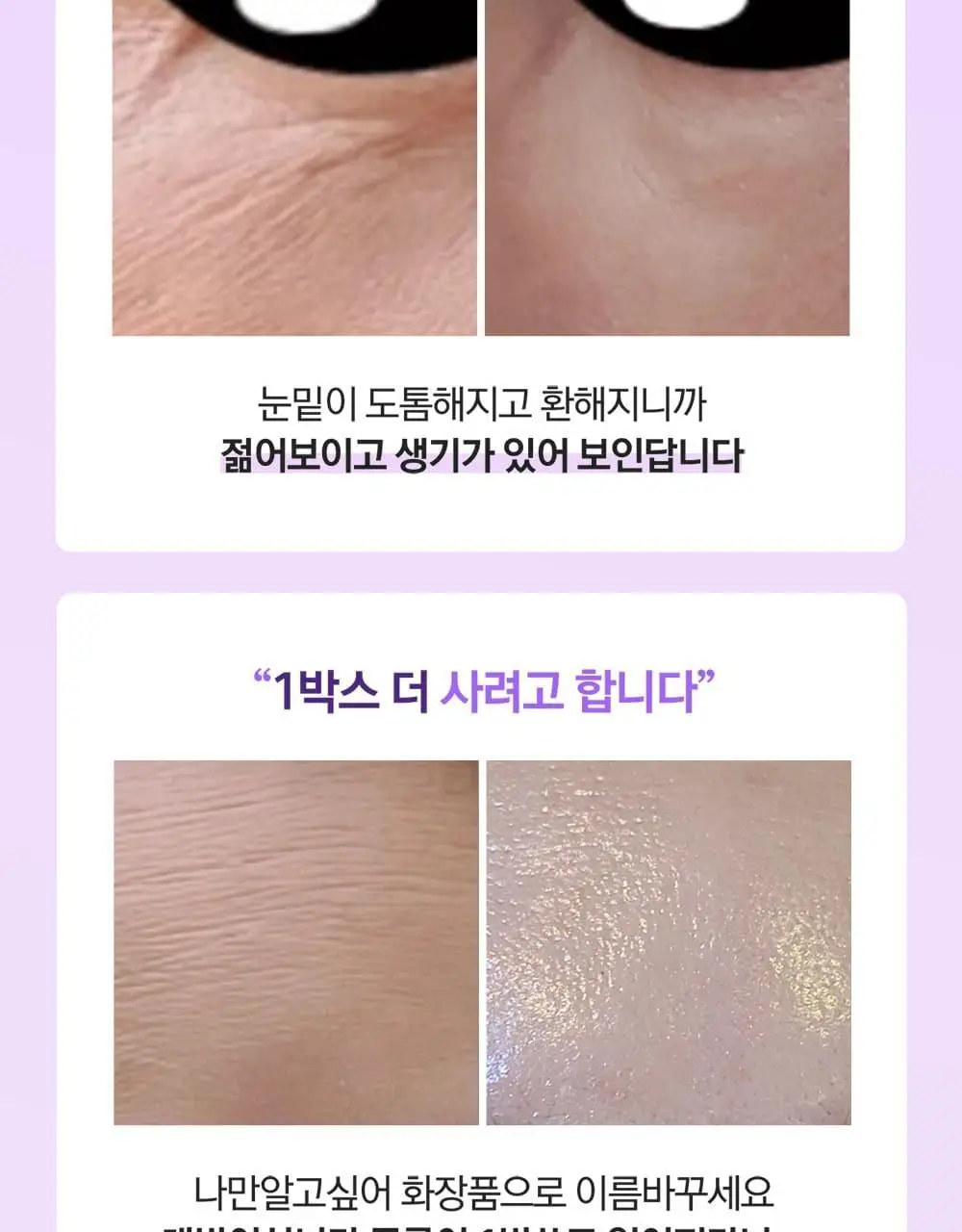 베리홉 바이오틱스 바이탈 아이 크림 20ml 상세페이지 4
