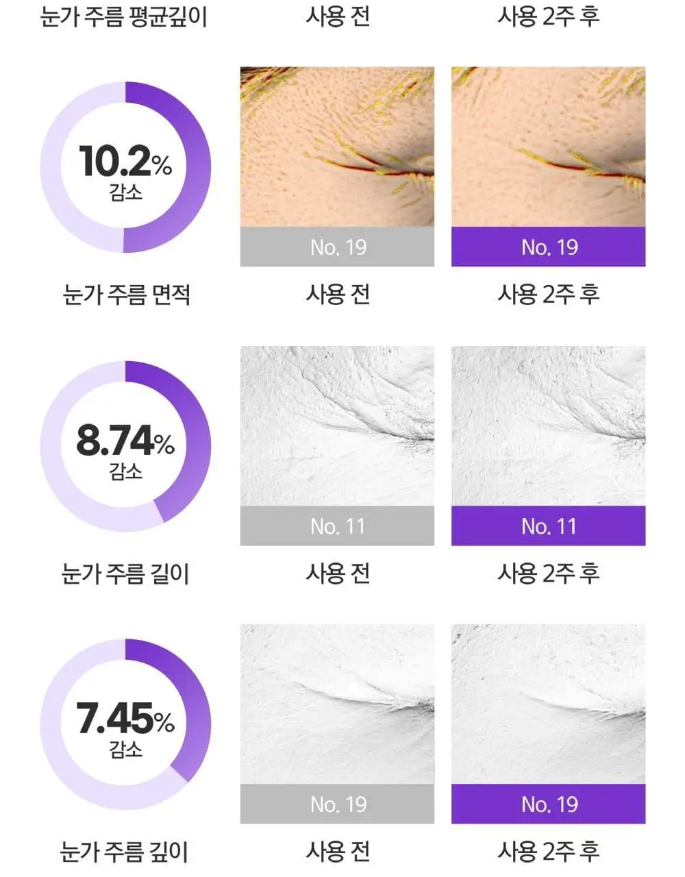 베리홉 바이오틱스 바이탈 아이 크림 20ml 상세페이지 13