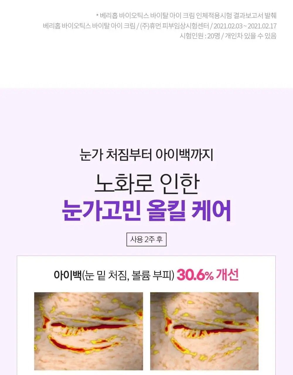 베리홉 바이오틱스 바이탈 아이 크림 20ml 상세페이지 14