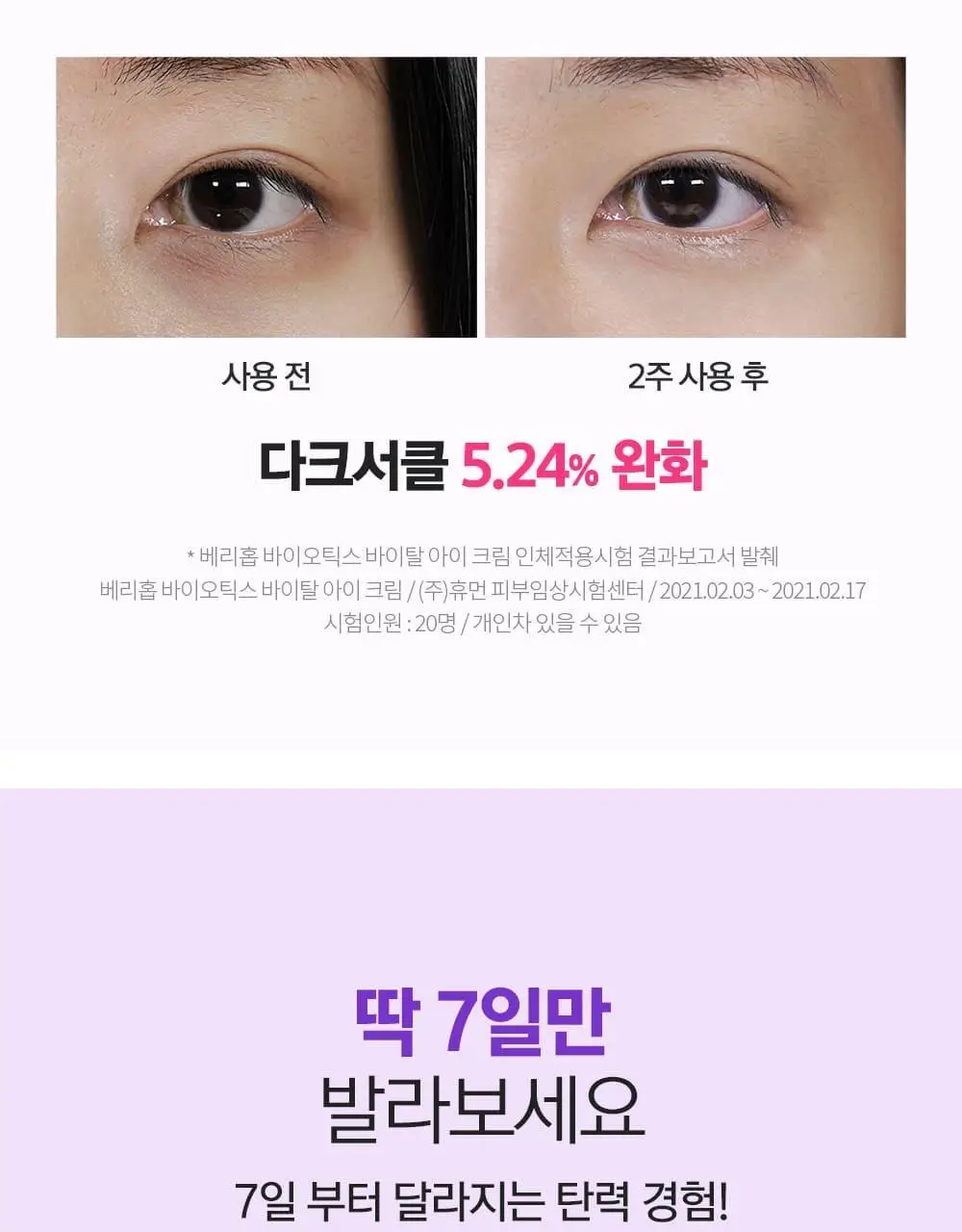 베리홉 바이오틱스 바이탈 아이 크림 20ml 상세페이지 16