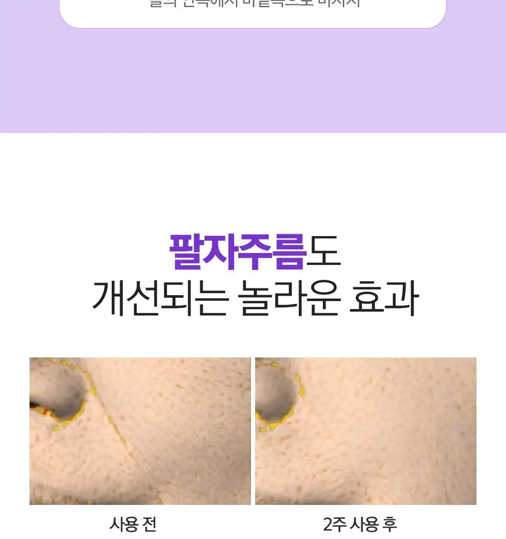 베리홉 바이오틱스 바이탈 아이 크림 20ml 상세페이지 30