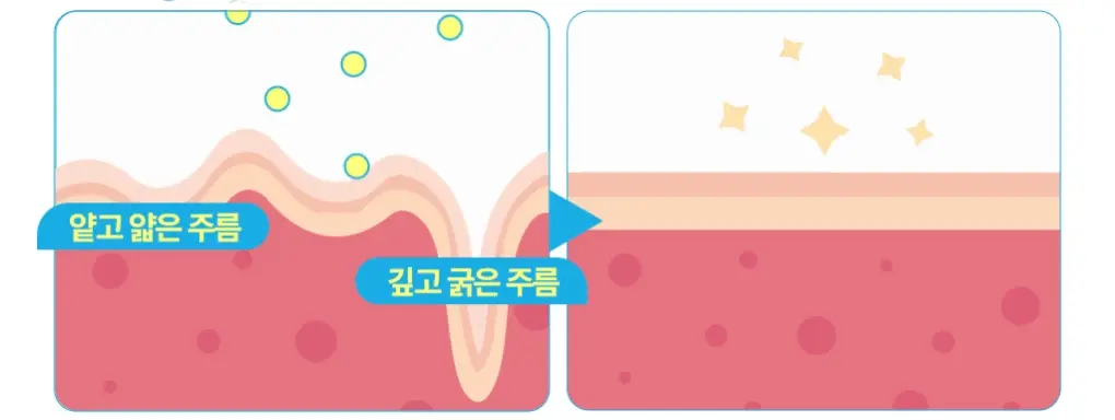 브링그린 슈퍼레몬 글루타치온 아이크림 30mL 더블기획 상세페이지 13
