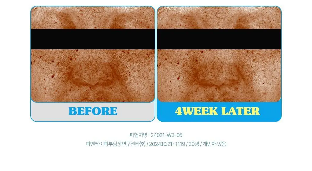 브링그린 슈퍼레몬 글루타치온 아이크림 30mL 더블기획 상세페이지 22