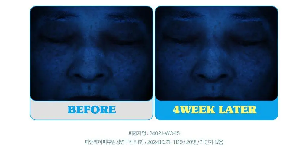 브링그린 슈퍼레몬 글루타치온 아이크림 30mL 더블기획 상세페이지 24