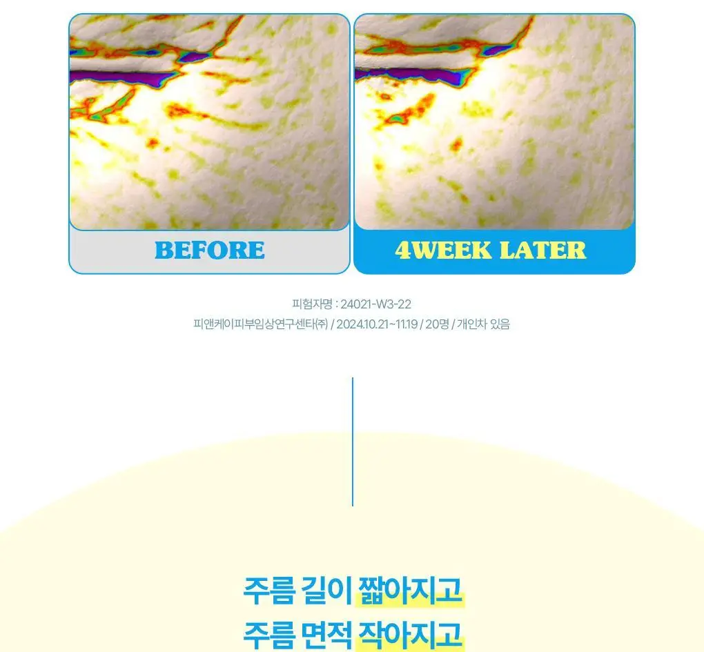 브링그린 슈퍼레몬 글루타치온 아이크림 30mL 더블기획 상세페이지 26