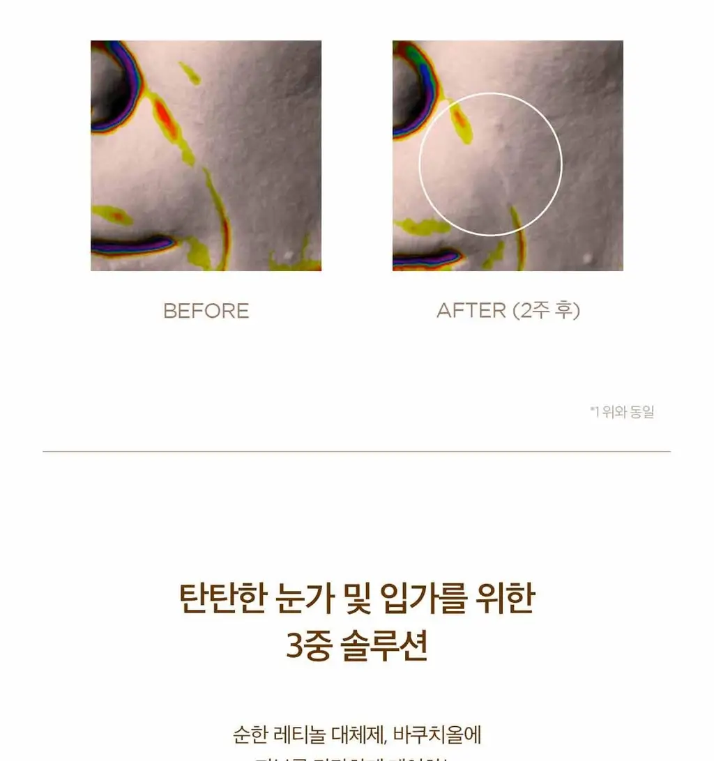 스킨1004 마다가스카르 센텔라 프로바이오시카 바쿠치올 아이 크림 20ml 상세페이지 7