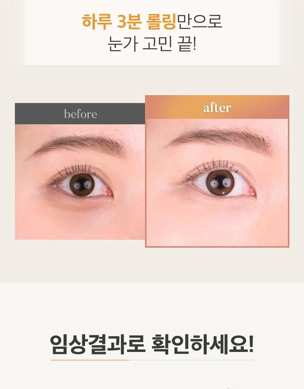 시모먼트 아이 리프팅 롤러 세럼 15ml 상세페이지 3
