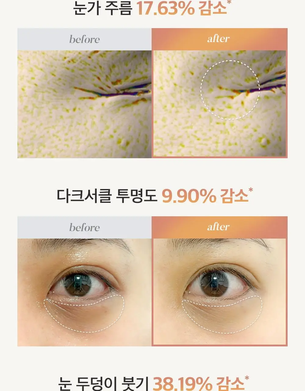 시모먼트 아이 리프팅 롤러 세럼 15ml 상세페이지 4
