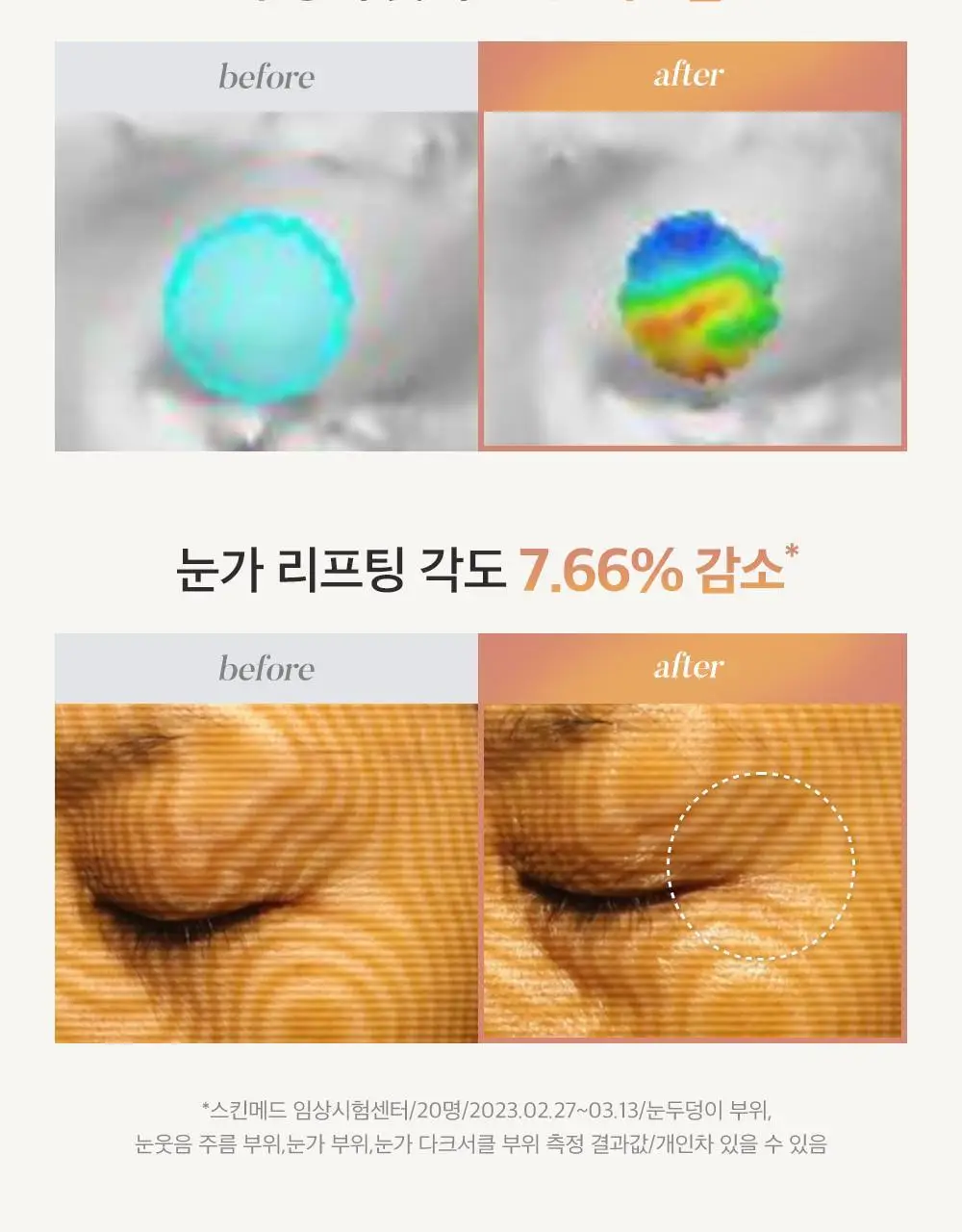 시모먼트 아이 리프팅 롤러 세럼 15ml 상세페이지 5
