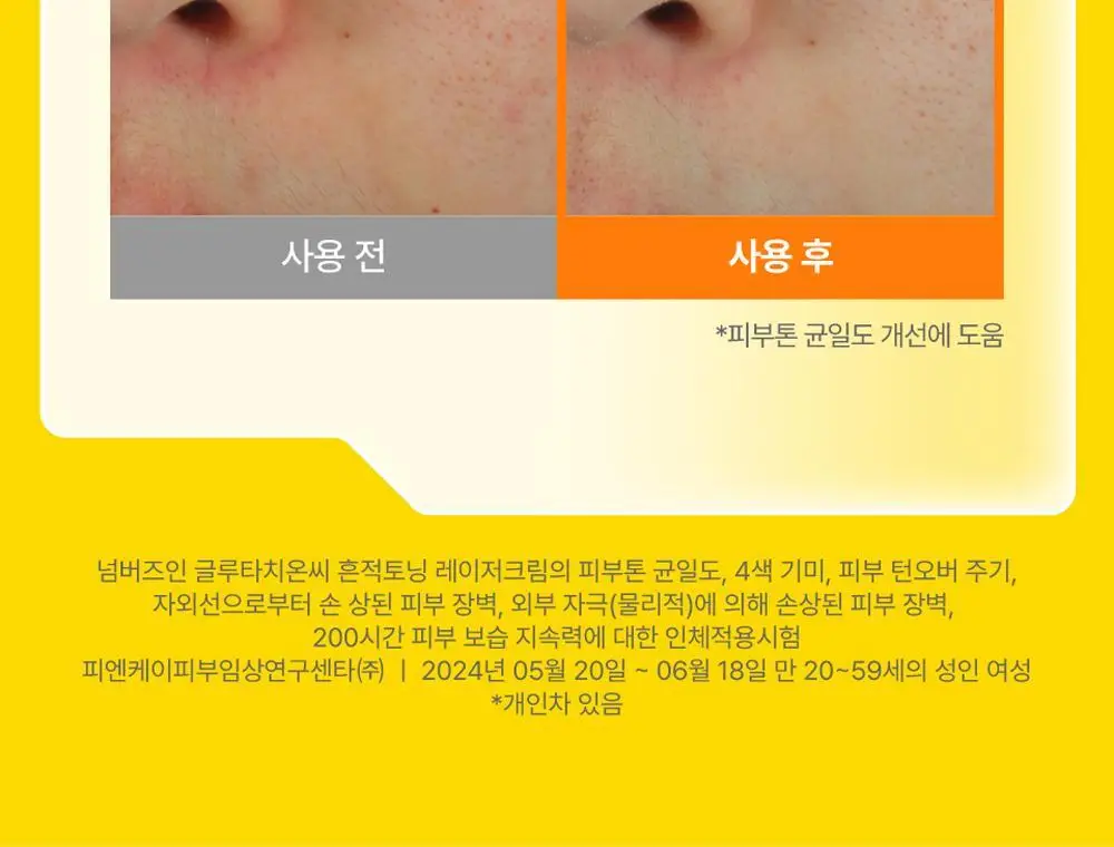 넘버즈인 5번 글루타치온씨 흔적 토닝 레이저 크림 50ml 상세페이지 15