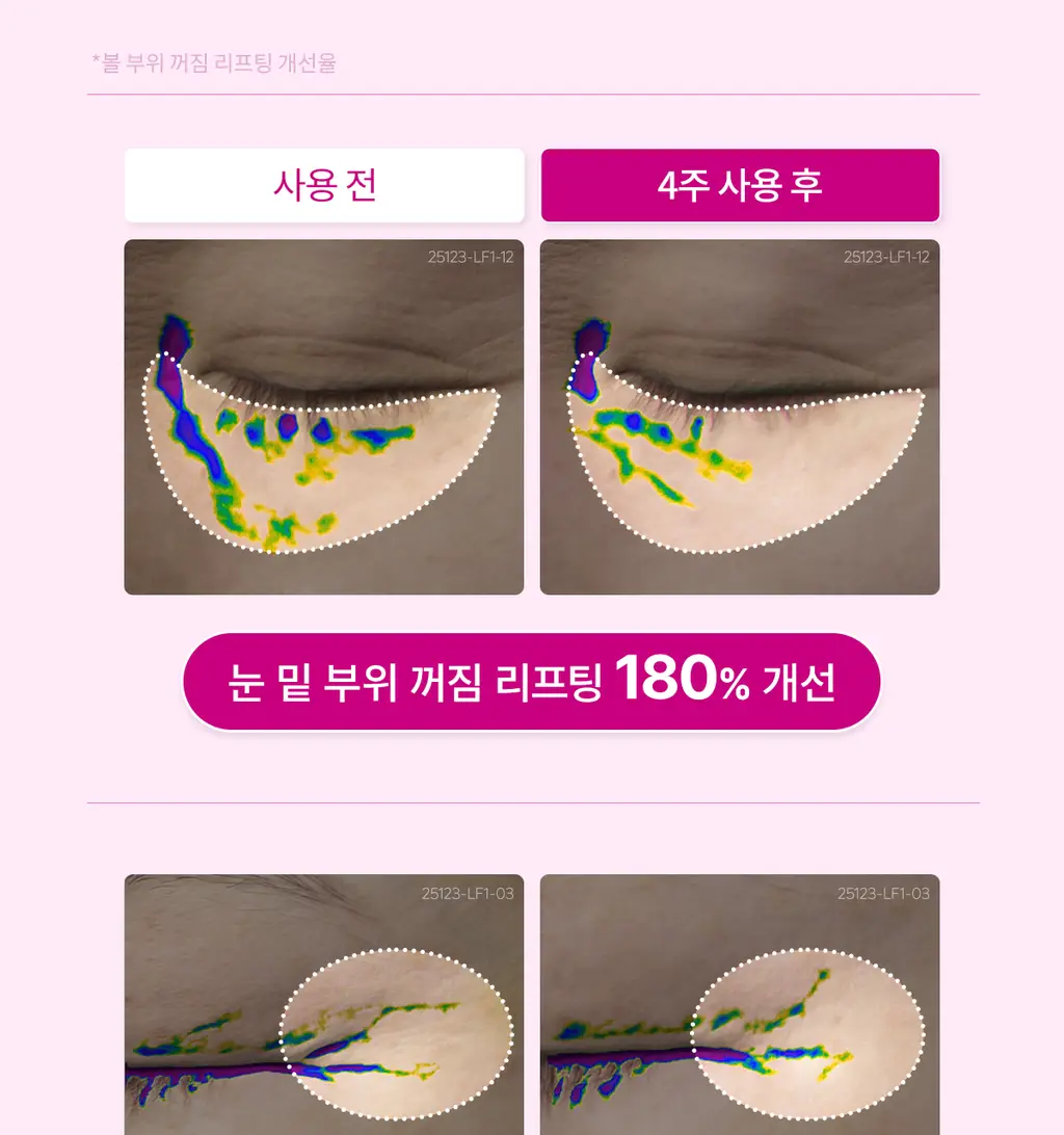닥터멜락신 시멘리트 칼슘 볼륨 크림 50ml 상세페이지 6