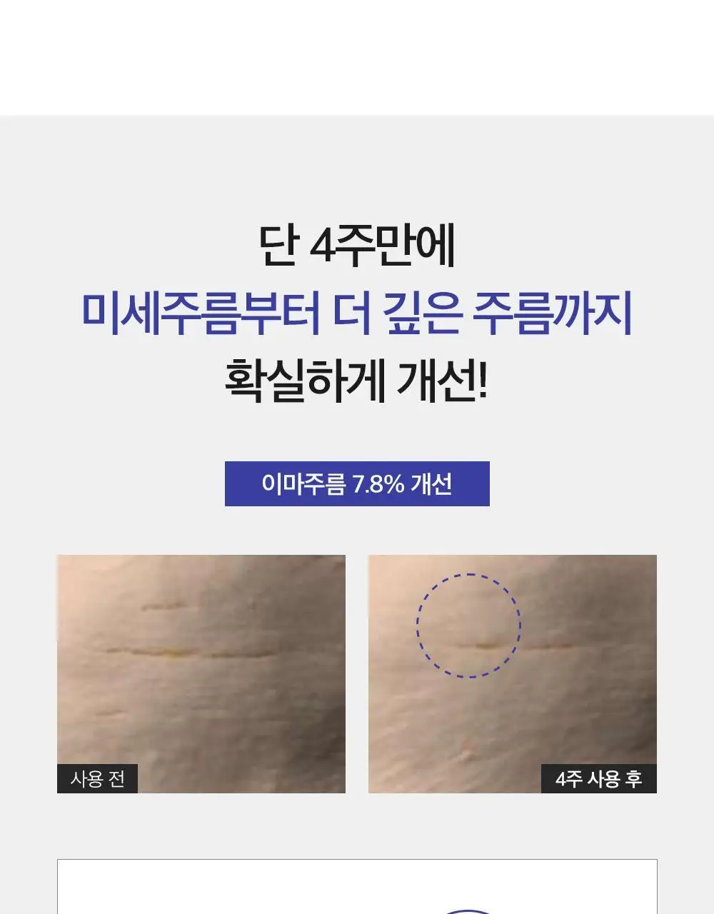 더마팩토리 레티날 300ppm크림 30ml 상세페이지 14