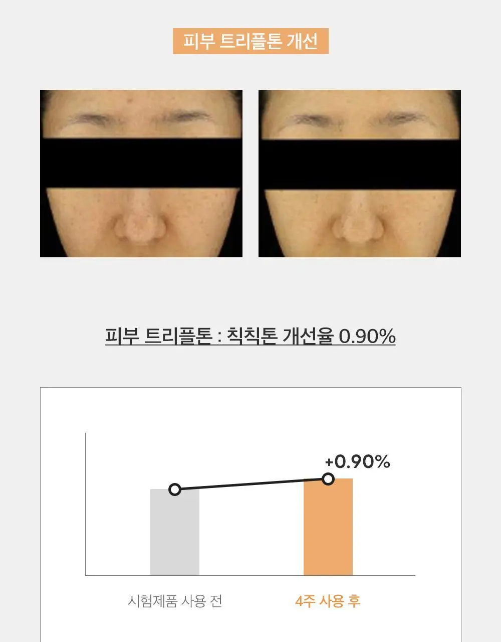 더마팩토리 트라넥삼산 6% 크림 30ml 상세페이지 21
