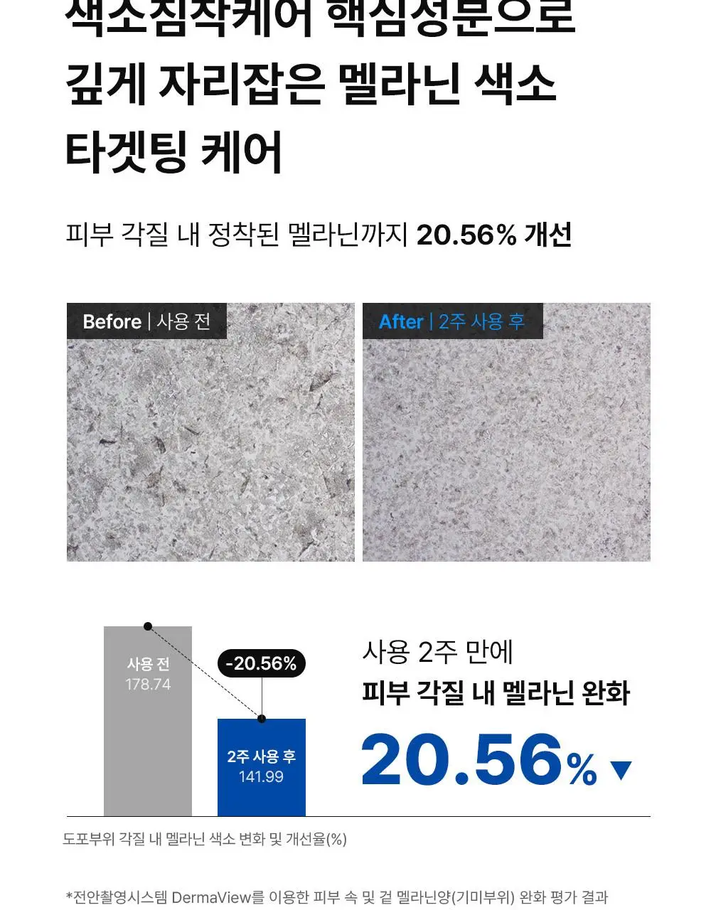 동아제약 색소침착 프로 크림제 40ml 더블 기획 (+40ml) 상세페이지 15
