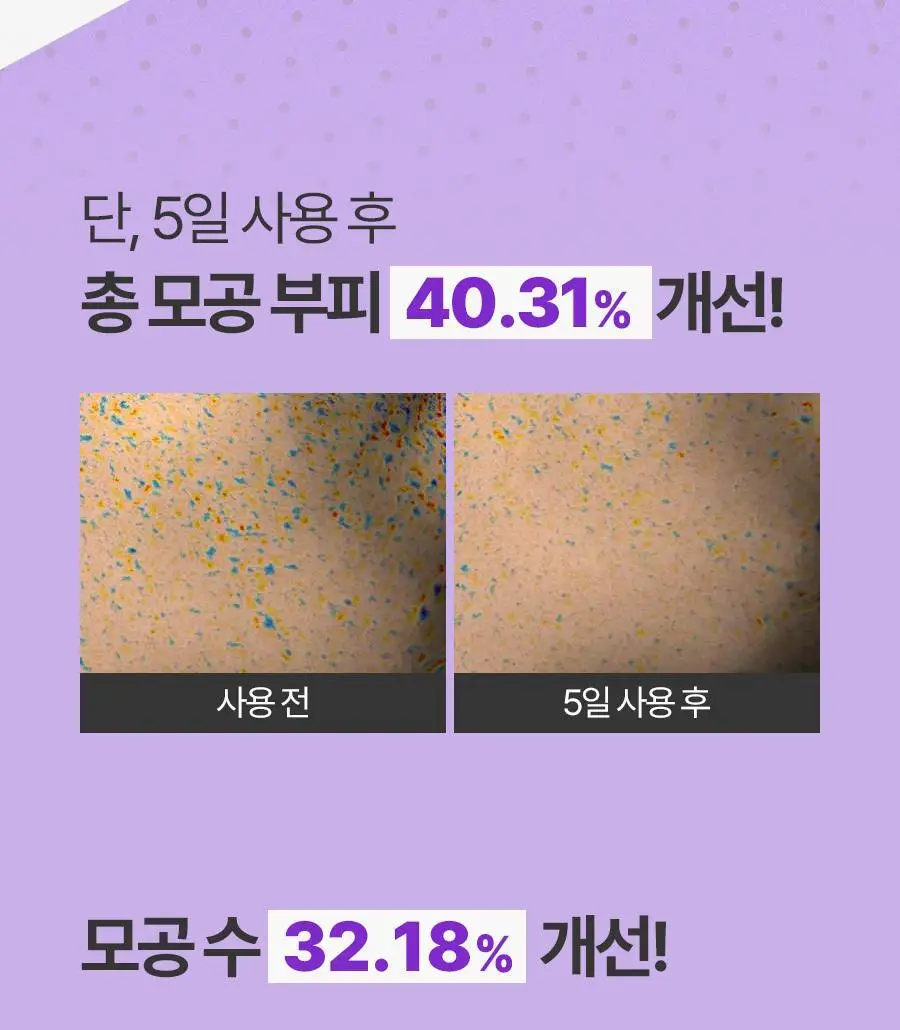 루트리 오디베리 5중 모공 리프팅 크림 50ml 상세페이지 15