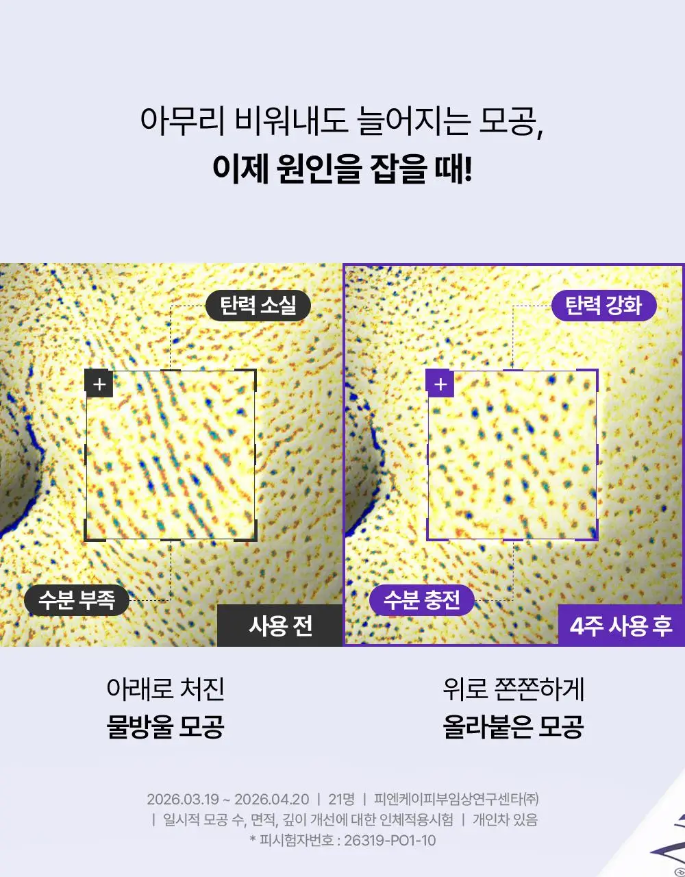 리쥬란 더마 힐러 포어 타이트닝 크림 50ml(+포어 앰플 10ml 증정)/50ml 단품 상세페이지 3
