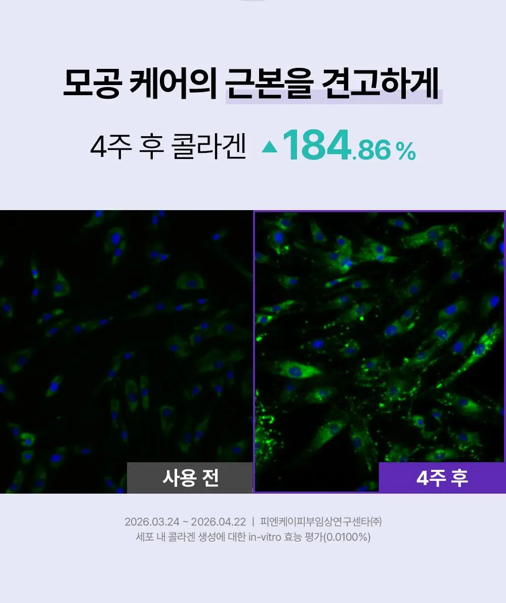리쥬란 더마 힐러 포어 타이트닝 크림 50ml(+포어 앰플 10ml 증정)/50ml 단품 상세페이지 14