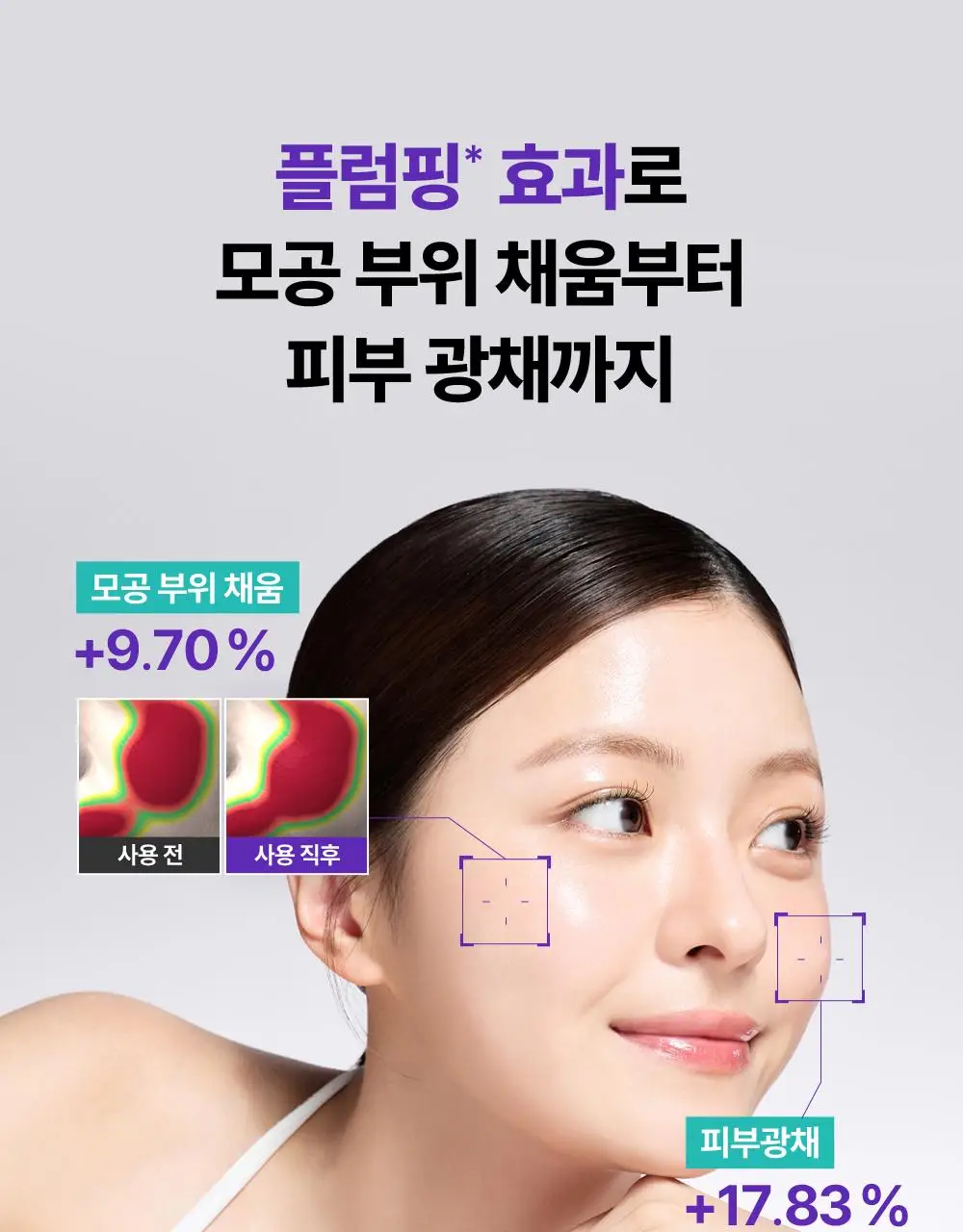 리쥬란 더마 힐러 포어 타이트닝 크림 50ml(+포어 앰플 10ml 증정)/50ml 단품 상세페이지 21