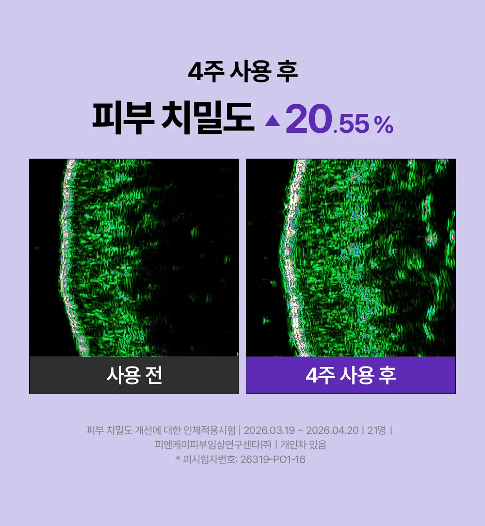 리쥬란 더마 힐러 포어 타이트닝 크림 50ml(+포어 앰플 10ml 증정)/50ml 단품 상세페이지 25