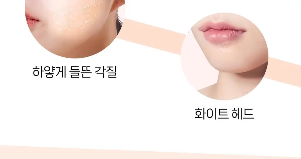 메디올가 메디 아하 크림 스트롱 1+1 기획(30ml+30ml) 상세페이지 13