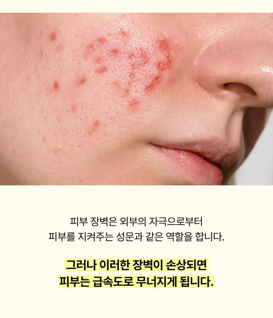 셀라딕스 트러블 세라 캡슐 131 크림 95ml 상세페이지 11