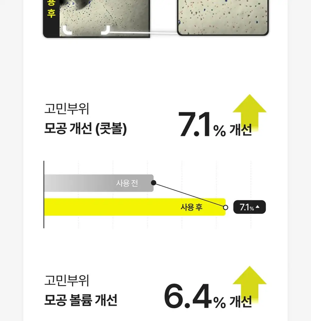 셀리맥스 더 비타 A 레티날 샷 타이트닝 듀얼 크림 50ml 상세페이지 38