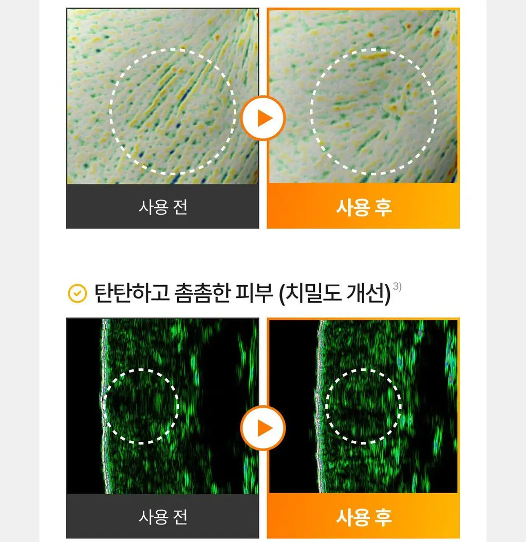셀리맥스 브라이트닝 모공잡티크림 35ml 기획 (+7ml*2) 상세페이지 25