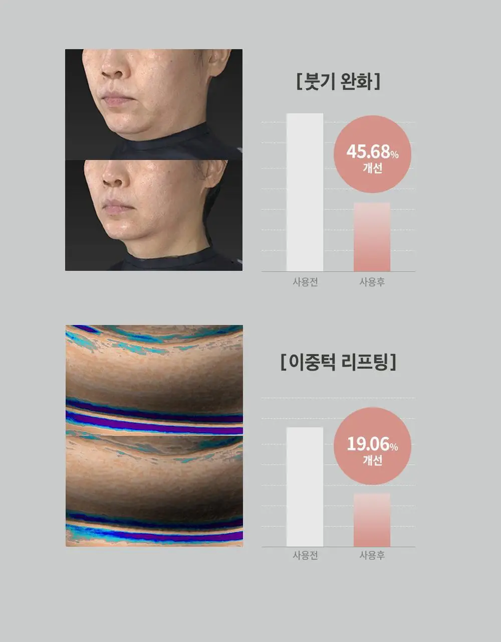 시모먼트 브이 리프팅 롤러 크림 150ml (교체형) 상세페이지 3