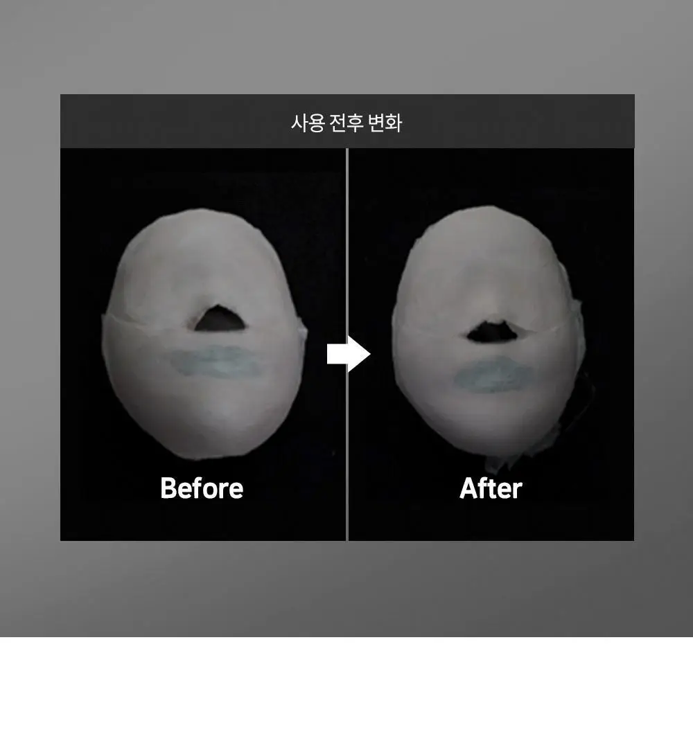 시모먼트 브이 리프팅 롤러 크림 150ml (교체형) 상세페이지 29