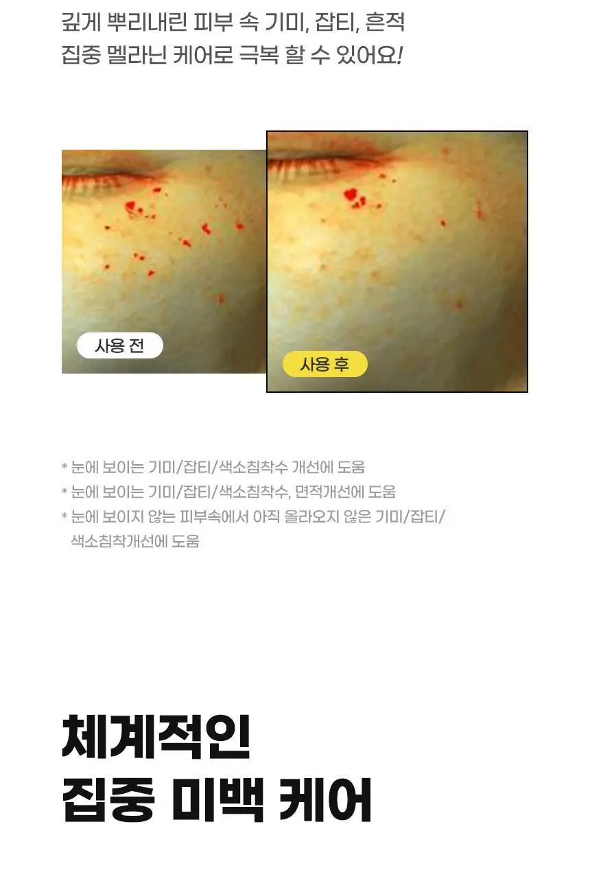 앰플엔 블레미샷 푹잠크림 50ml 상세페이지 23