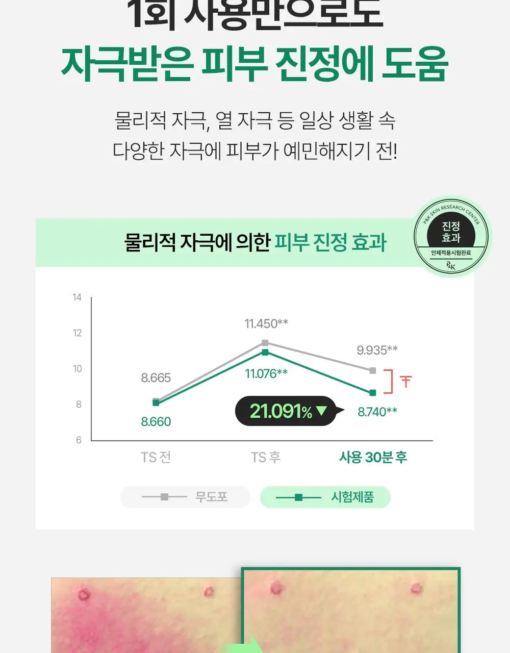 에센허브 티트리 수딩 인 카밍 크림 80ml 기획(+크림 30ml) 상세페이지 19