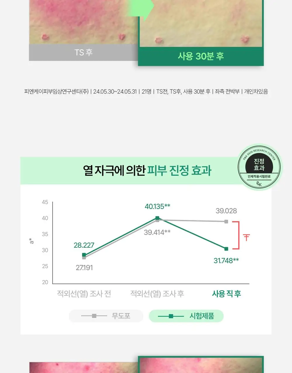 에센허브 티트리 수딩 인 카밍 크림 80ml 기획(+크림 30ml) 상세페이지 20