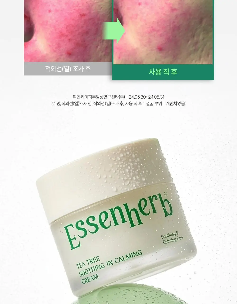 에센허브 티트리 수딩 인 카밍 크림 80ml 기획(+크림 30ml) 상세페이지 21