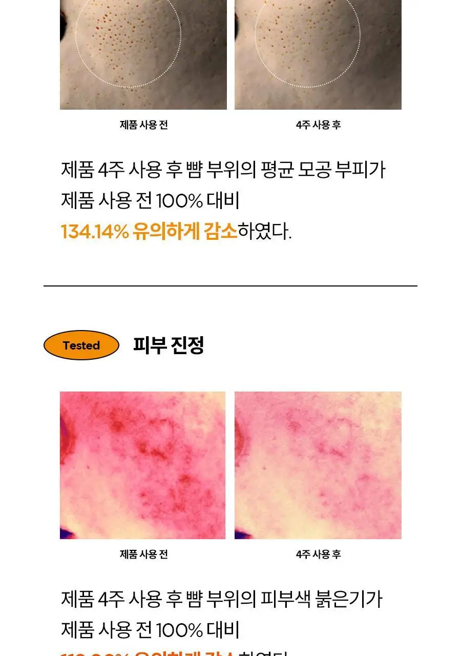 이즈앤트리 하이퍼 비타민 C 30 크림 20ml 상세페이지 17